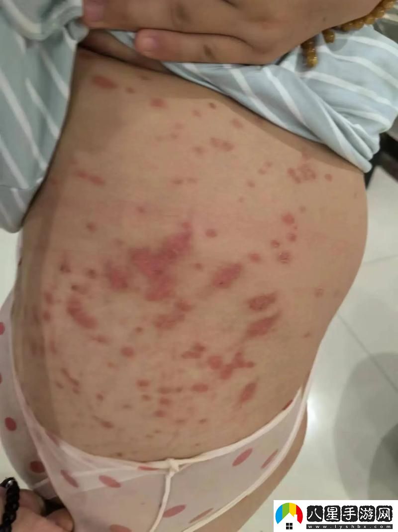 科技狂潮下的皮膚疙瘩謎團